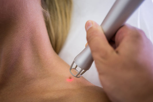 Skin Biopsy